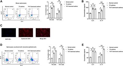 MBD2 mediates Th17 cell differentiation by regulating MINK1 in Th17-dominant asthma